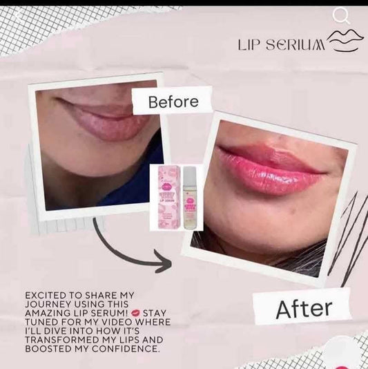 Sweet Kiss Lip Serum