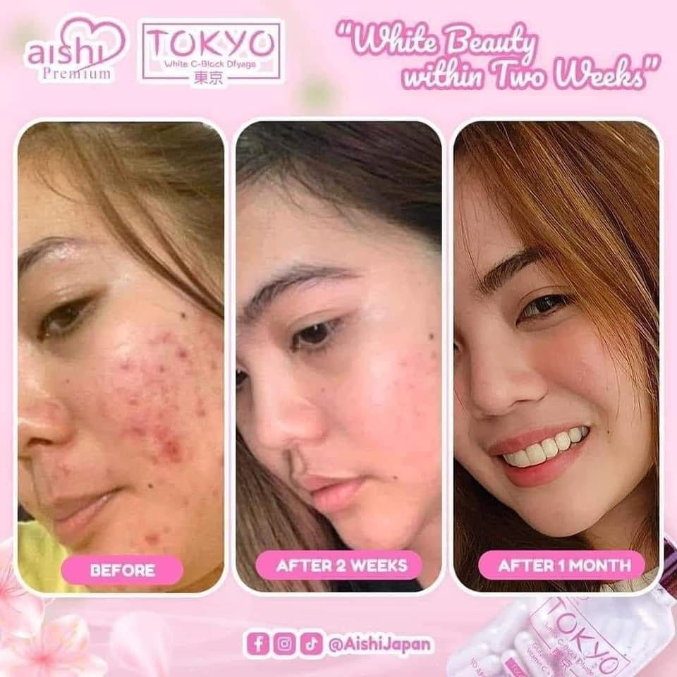 Aishi Premium Tokyo (Glutathione)